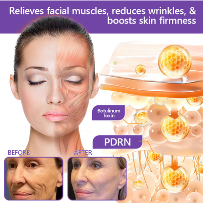 AU Australia Compliant : HISKIN® PDRN Multi-Peptide Massaging Body Roller Cream- Anti-aging, Hydrating, Skin Firming & Lifting, Skin Repair, Even Tone, Acne and Dark Spot Treatment, Wart and Mole Removal, and Psoriasis Relief.