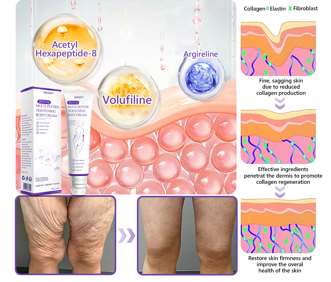 AU Australia Compliant : HISKIN® PDRN Multi-Peptide Massaging Body Roller Cream- Anti-aging, Hydrating, Skin Firming & Lifting, Skin Repair, Even Tone, Acne and Dark Spot Treatment, Wart and Mole Removal, and Psoriasis Relief.